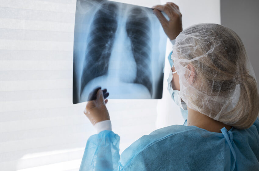  Com maior incidência do Estado, Barretos registra 403 casos e 26 mortes por doenças respiratórias em 7 meses